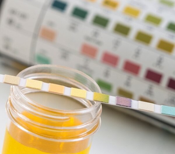 cbd test sang